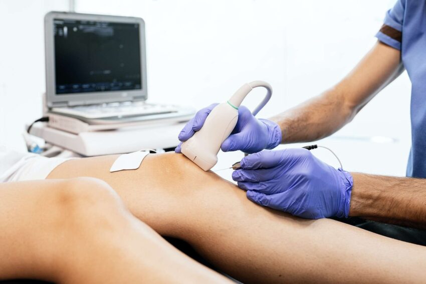 electrolisis percutanea